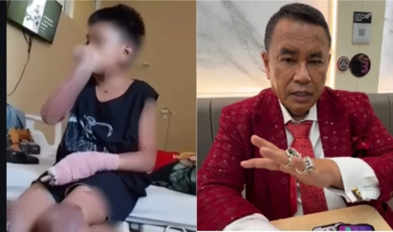 Announced: Hotman Paris Kritik Penanganan Kasus Santri Terbakar di NTB, Sebut Korban Tak Dioperasi tapi Diisolasi di RS Bhayangkara