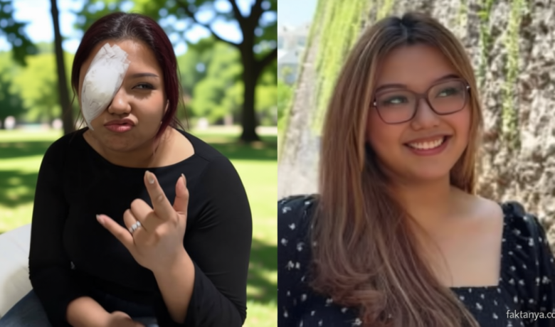Kondisi Terkini Trisha Eungelica Anak Ferdy Sambo Usai Alami Cedera Mata