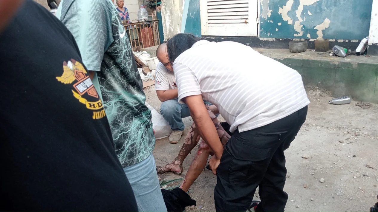 Pria di Tanjung Priok Tersengat Listrik Saat Hendak Curi Kabel Gardu, Alami Luka Bakar 70 Persen